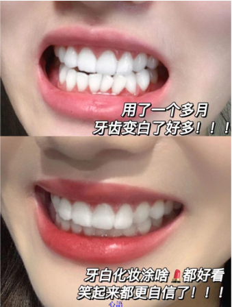 【全網火爆】牙齒美白首選——#買一贈二「益生菌口腔美白鯊魚牙膏」快美白!強健齒!淨口氣!科學檢測有效,洗掉大黃牙!