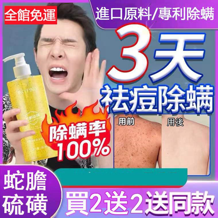  【日本專利配方】【蛇膽硫磺除螨沐浴乳】蛇膽精華 水感養膚還你水嫩肌膚！男女都適用，全身可用！