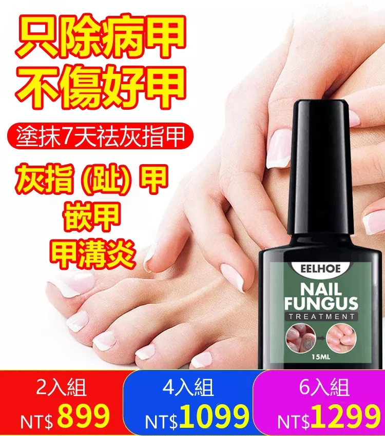 限時搶購 得了灰指甲，一個傳染兩，早發現早治療!別在花冤枉錢,一用它3天就見效！然草本抗菌配方，深入滲透，只去壞甲不傷好甲，永久治療灰指甲