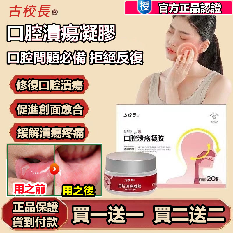 【正品保障】古校長口腔潰瘍凝膠 口腔問題專用!徹底斷根不反复!