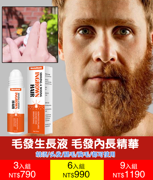 買二送一!West&Month毛髮逆生長精華 買二送一!West&Month毛髮逆生長精華