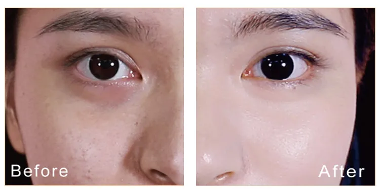 1685185456348360.png 0cb53f9bbf726d53bd113bdf00f1eca.png